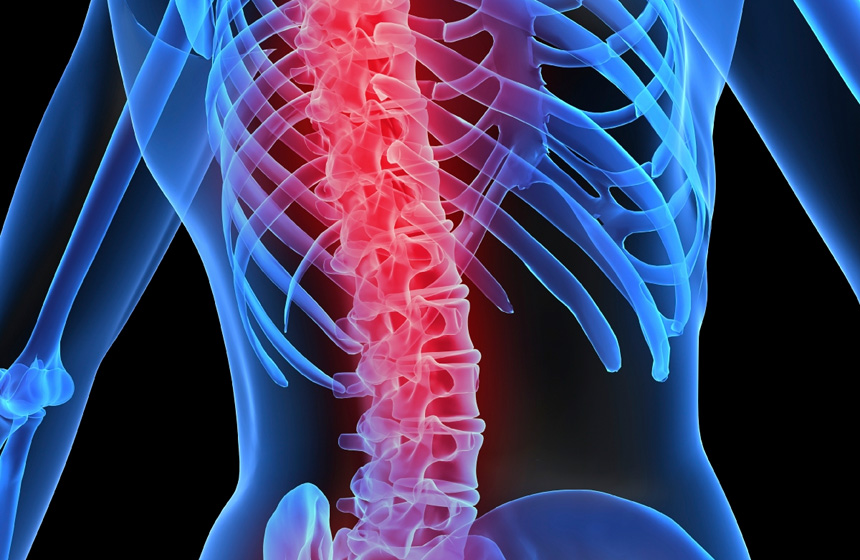 osteoporosis in men