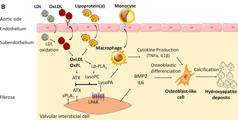 LDL oxidada