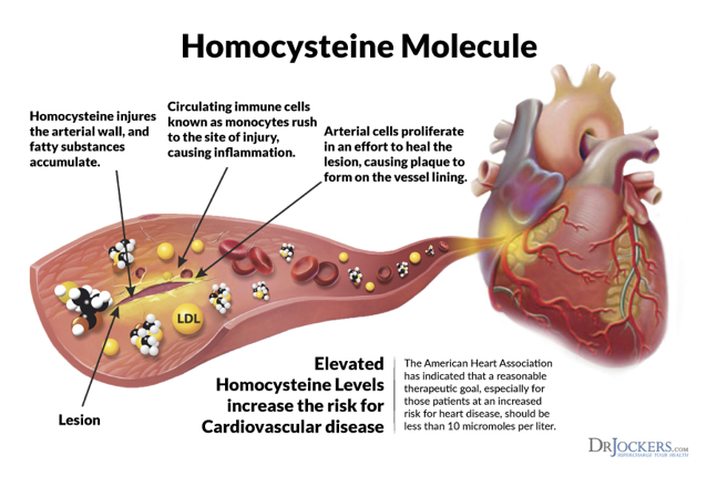 homocisteina