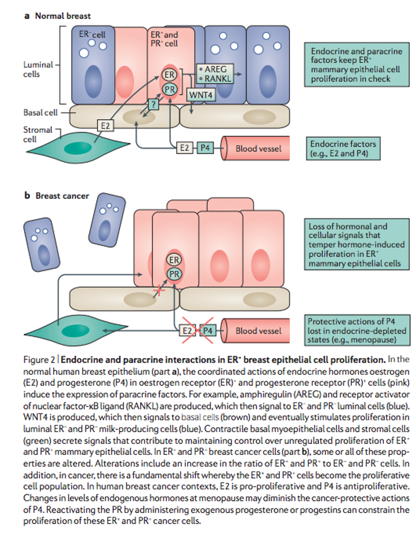 HRT and breast cancer