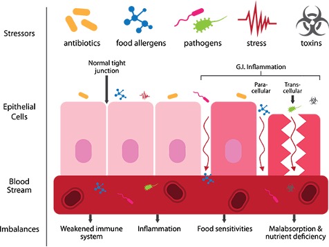 Microbiota intestinal