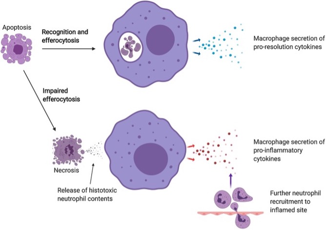 Envejecimiento como persistencia de la inflamaci�n