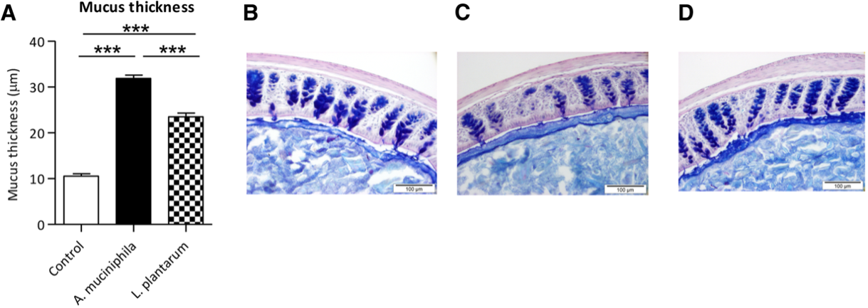 Microbiota intestinal