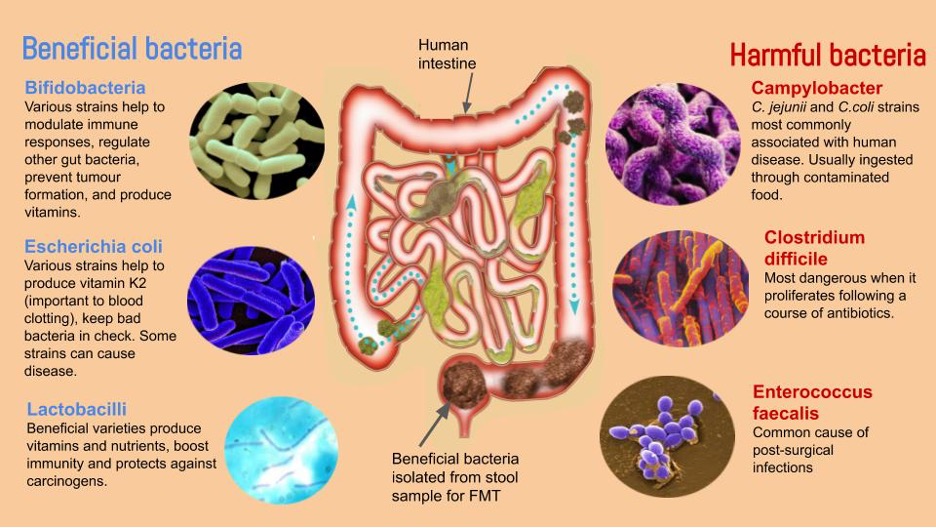 Brain-Gut-Microbiota