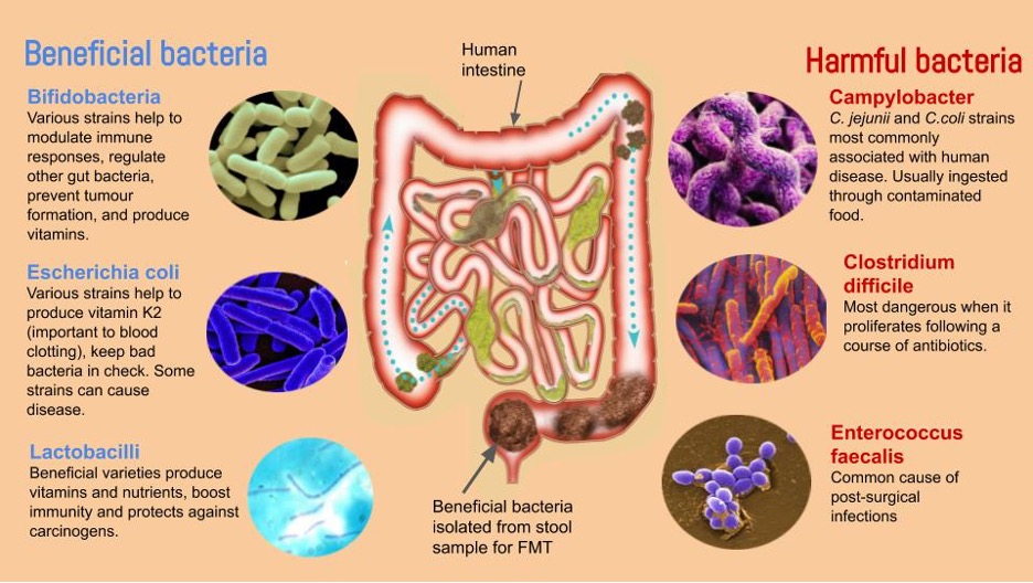 Intestino cerebro microbiota