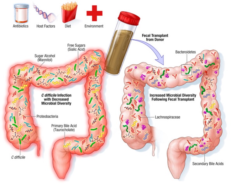 Intestino cerebro microbiota