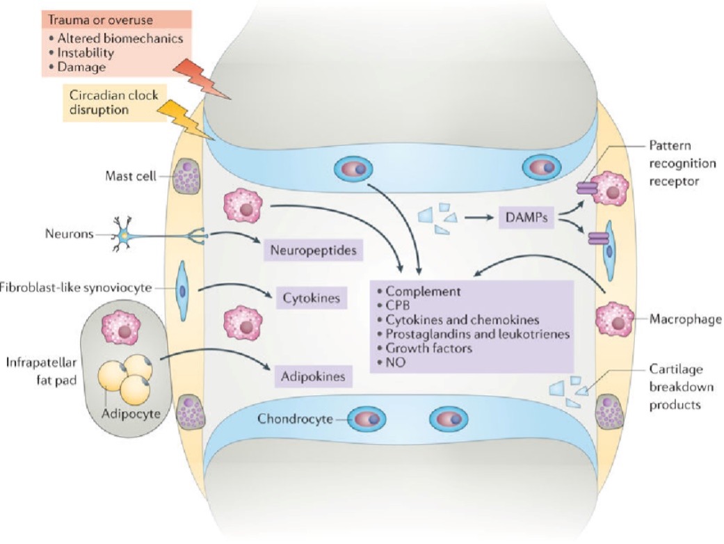 osteoartritis