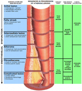 arteria