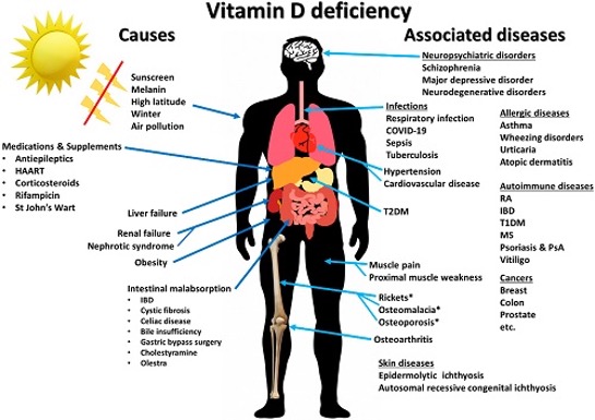 vitamina D