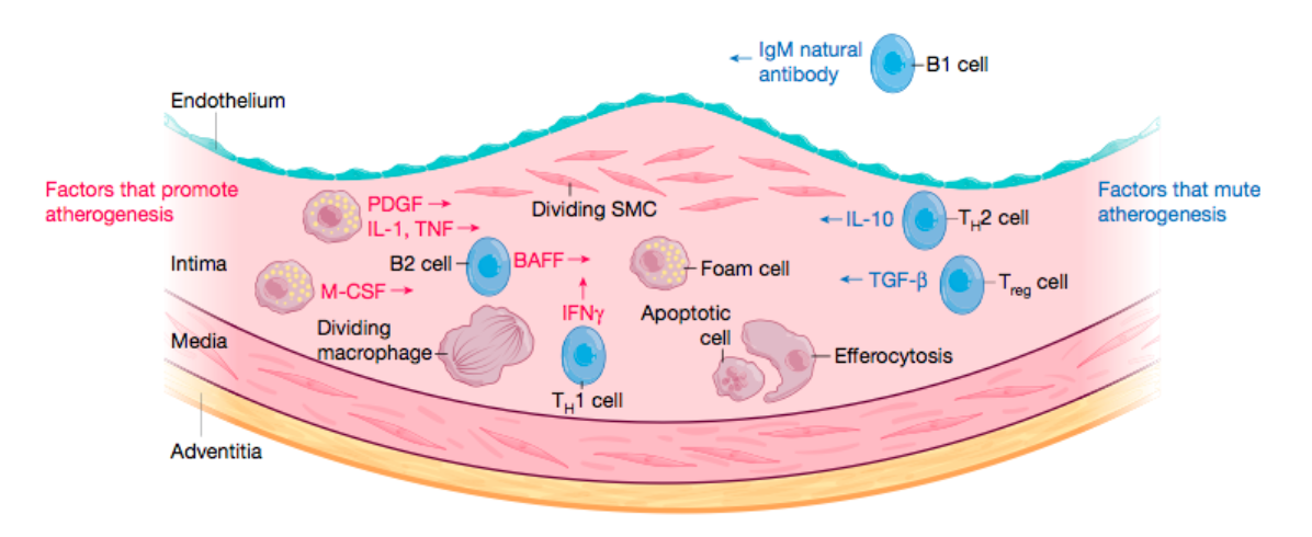 Ateroesclerosis